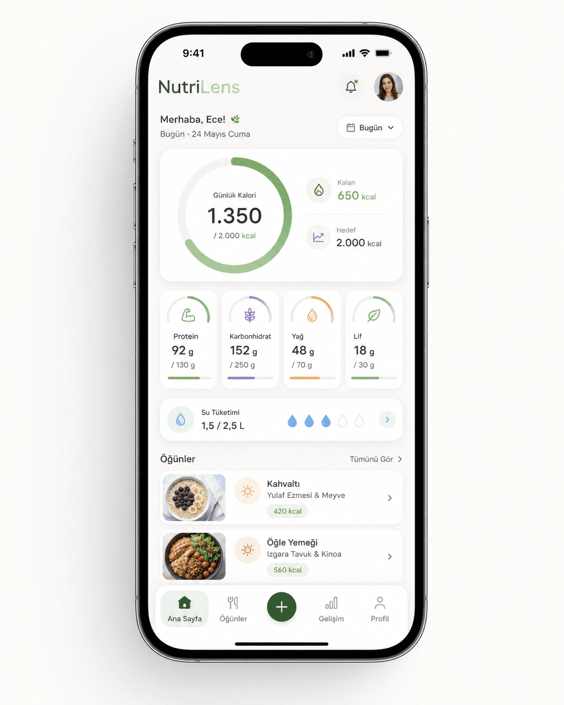 NutriLens daily dashboard screen